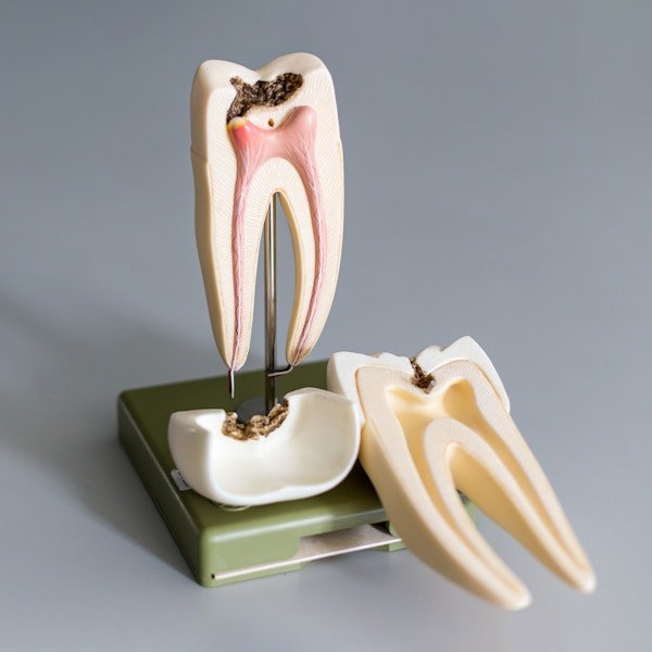 Root Canal model