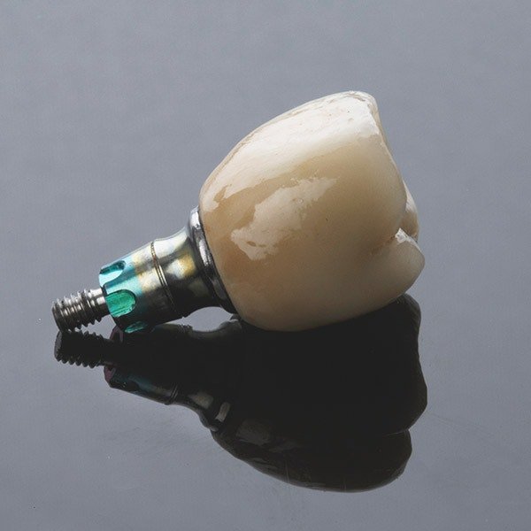 Dental implant