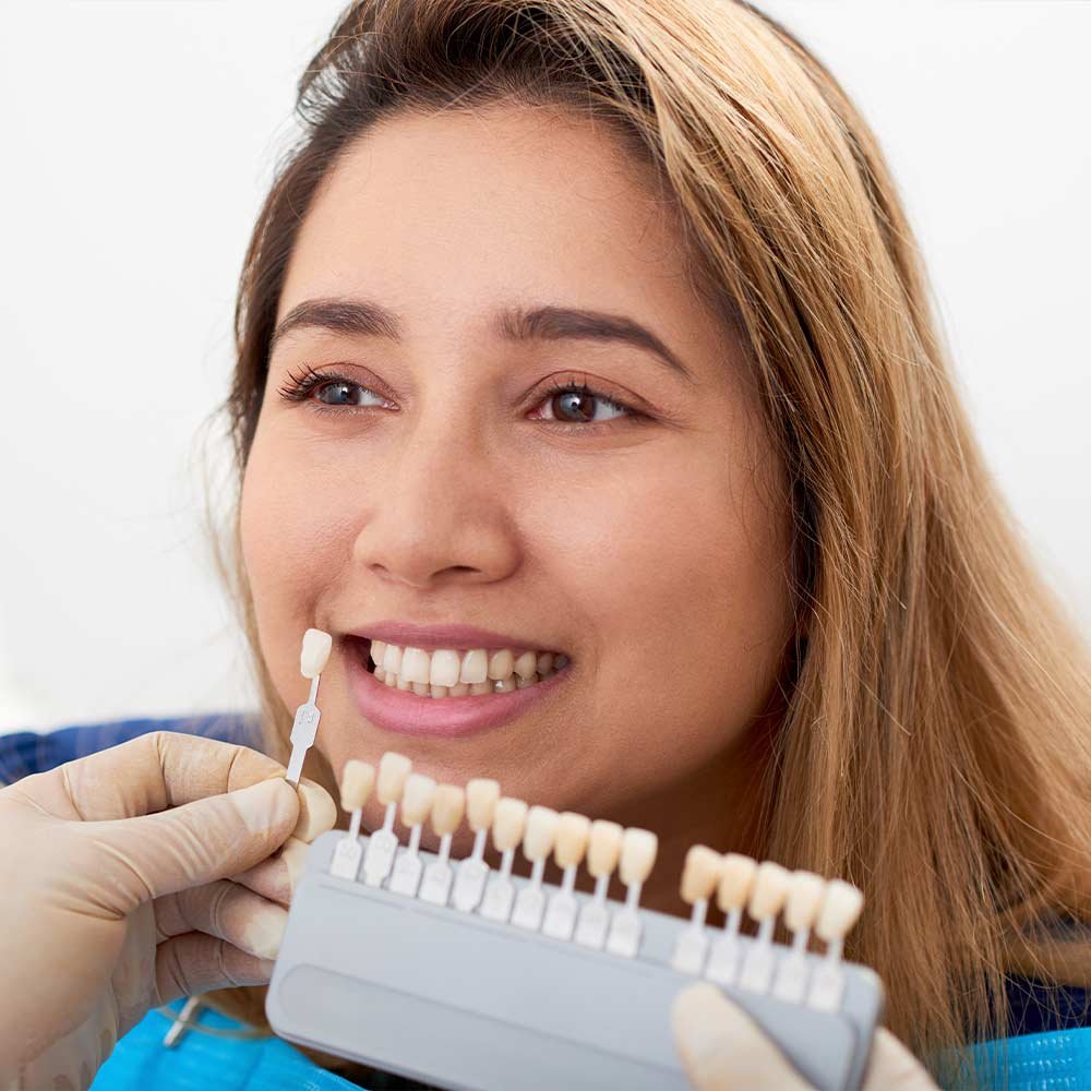 Different tooth color options for veneers