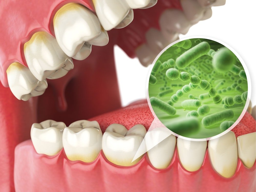 illustration showing bacteria on teeth